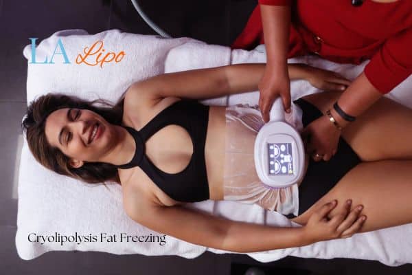 woman getting cryolipolysis Lowestoft