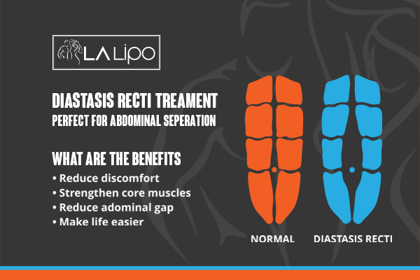 When to Be Concerned About Abdominal Muscle Changes Lowestoft
