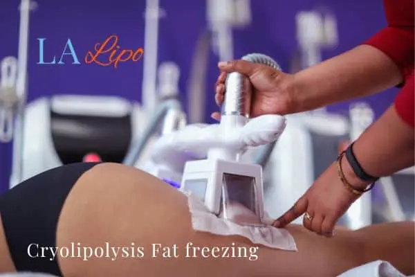women getting fat freezing Lowestoft