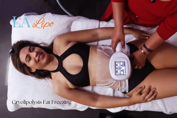 woman getting cryolipolysis Lowestoft