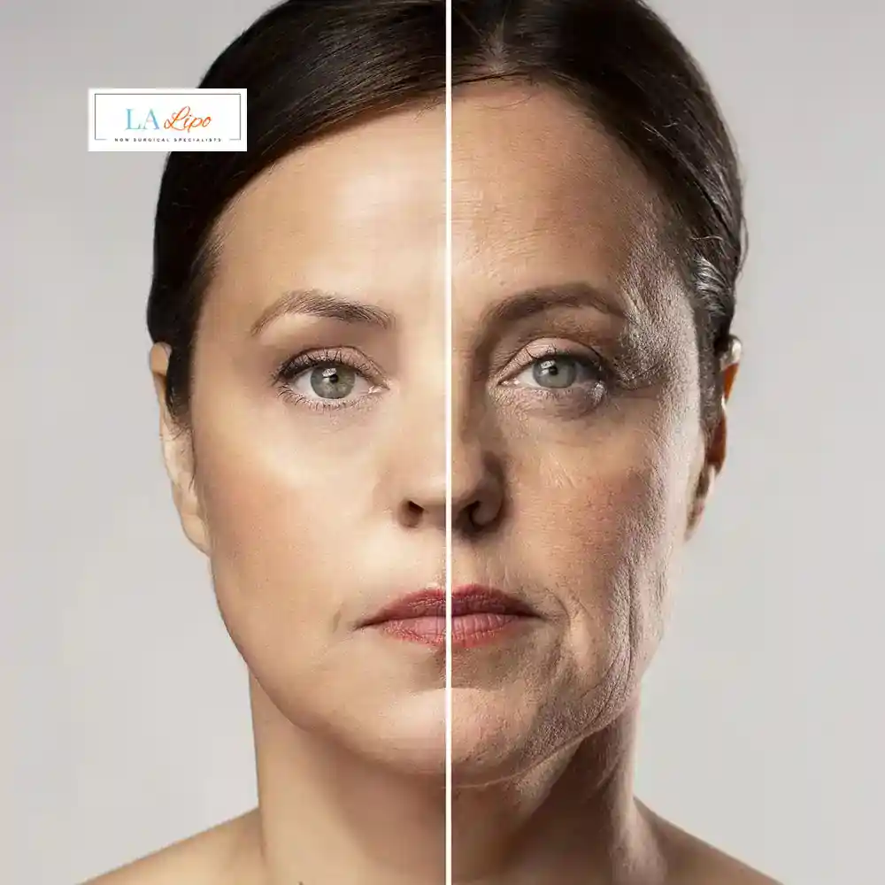 How Can You Tell If Non-Surgical Skin Tightening Is Right for You Lowestoft?