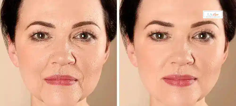 Why Aren’t My Skincare Products Making My Sagging Skin Look Firmer Lowestoft?