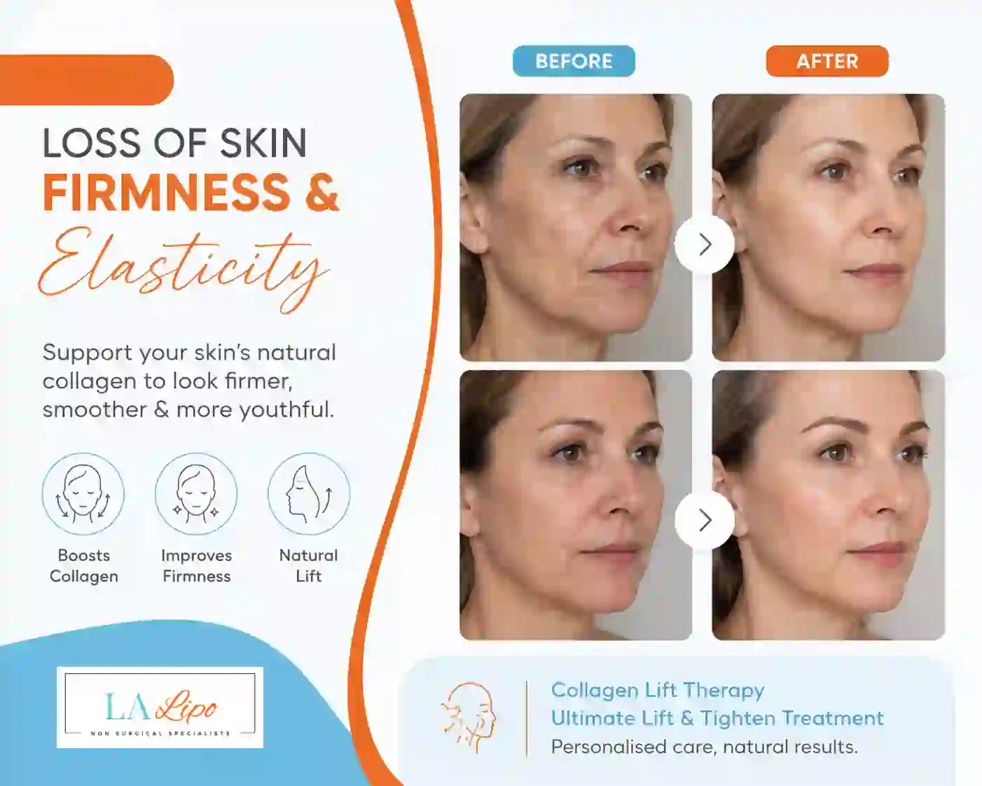 Sign #7: Loss of Skin Firmness and Elasticity Lowestoft